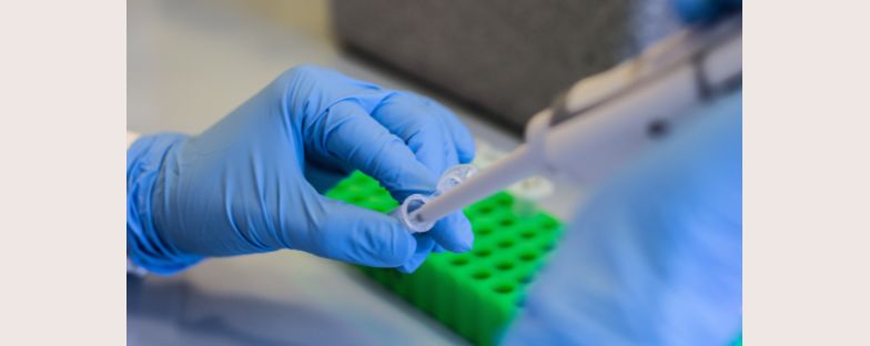 La piattaforma di ricerca di Fondazione Umberto Veronesi ETS sul tumore del polmone si amplia di un nuovo progetto