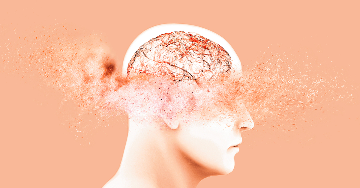 Cos’è e come si cura l’aneurisma cerebrale Cos’è e come si cura l’aneurisma cerebrale