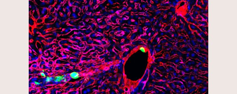 Immunoterapia per le metastasi al fegato da tumore al colon-retto